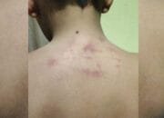 Terkait Pemukulan Siswa, Pihak Pondok Pesantren di Agara Enggan Ngasih Keterangan